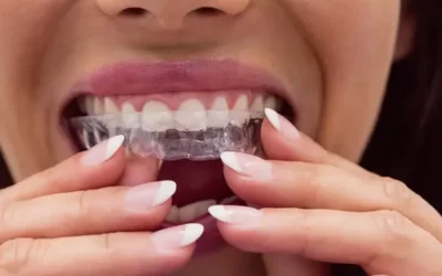 Invisalign Porter Ranch: Clear Aligner Therapy for Discreet Orthodontic Correction